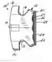Fig. 01 - Pre-cemented orthodontic appliances
