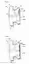 Fig. 02 - Pre-cemented orthodontic appliances