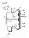 Fig. 03 - Pre-cemented orthodontic appliances
