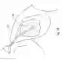 Fig. 03 - Kits comprising a plurality of bite ramps having different angles for orthodontic treatment