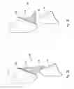 Fig. 05 - Kits comprising a plurality of bite ramps having different angles for orthodontic treatment