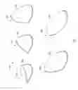 Fig. 10 - Kits comprising a plurality of bite ramps having different angles for orthodontic treatment