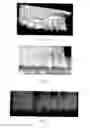 Fig. 02 - Method for the placement of orthodontic brackets