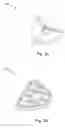 Fig. 04 - Dental articulator systems and methods