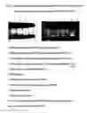 Fig. 06 - Method for diagnosis of tuberculosis by smear microscopy, culture and polymerase chain reaction using processed clinical samples and kit thereof