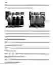 Fig. 07 - Method for diagnosis of tuberculosis by smear microscopy, culture and polymerase chain reaction using processed clinical samples and kit thereof