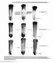 Fig. 09 - Method for diagnosis of tuberculosis by smear microscopy, culture and polymerase chain reaction using processed clinical samples and kit thereof