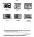 Fig. 12 - Method for diagnosis of tuberculosis by smear microscopy, culture and polymerase chain reaction using processed clinical samples and kit thereof