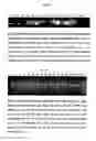 Fig. 16 - Method for diagnosis of tuberculosis by smear microscopy, culture and polymerase chain reaction using processed clinical samples and kit thereof