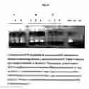 Fig. 18 - Method for diagnosis of tuberculosis by smear microscopy, culture and polymerase chain reaction using processed clinical samples and kit thereof