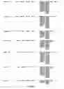 Fig. 46 - Inversion on chromosome 8p23 is a risk factor for anxiety disorders, depression and bipolar disorders