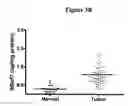 Fig. 07 - Tissue diagnostics for breast cancer