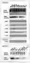 Fig. 06 - Method of determining efficacy of anticancer drug and determination kit therefor