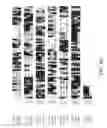 Fig. 13 - Vector system for selection of genes encoding secreted proteins and membrane-bound proteins