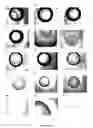 Fig. 06 - Use of dye to distinguish salt and protein crystals under microcrystallization conditions