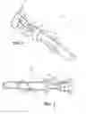 Fig. 02 - Electrical contact with wire trap