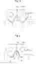 Fig. 03 - Double-sided engagement type silent chain