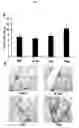 Fig. 06 - Remedy for sarcoidosis and method of treating the same