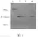 Fig. 03 - TREATMENT OF TUMOURS