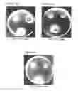 Fig. 07 - Method of modulating ion channel functional activity