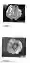 Fig. 03 - Hollow beads of polyethylene