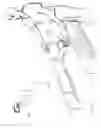 Fig. 08 - Method and apparatus to relax a patient to minimize the administration of anesthesia, facilitate successful surgery, and shorten recovery time