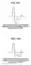 Fig. 11 - Vital information measuring device