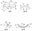 Fig. 07 - Ocular drug delivery device
