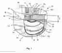 Fig. 02 - Absorbent article having a telescoping waist