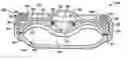 Fig. 01 - Variable flow infusion pump system