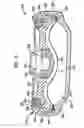 Fig. 06 - Variable flow infusion pump system