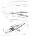 Fig. 02 - Apparatus and method for facilitating the replacement of an implanted catheter