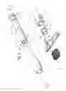 Fig. 03 - Apparatus and method for facilitating the replacement of an implanted catheter