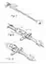 Fig. 05 - Apparatus and method for facilitating the replacement of an implanted catheter