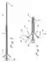 Fig. 03 - Ureteral access sheath