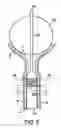 Fig. 07 - Apparatus and methods for treating female urinary incontinence