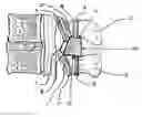 Fig. 01 - Inter-laminar support