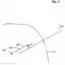 Fig. 02 - Application of therapy aligned to an internal target path