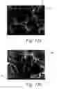 Fig. 14 - Deposition of discrete nanoparticles on an implant surface