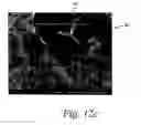 Fig. 15 - Deposition of discrete nanoparticles on an implant surface