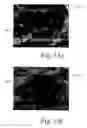 Fig. 16 - Deposition of discrete nanoparticles on an implant surface