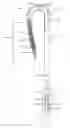 Fig. 05 - Medical implant deployment tool