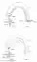 Fig. 09 - Medical implant deployment tool