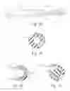 Fig. 20 - SURGICAL REPAIR SYSTEMS AND METHODS OF USING THE SAME