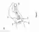 Fig. 02 - Apparatus and method for releasing tendon sheath