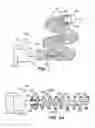 Fig. 02 - Anchor assemblies in stretch-resistant vaso-occlusive coils