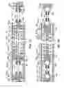 Fig. 07 - Anchor assemblies in stretch-resistant vaso-occlusive coils