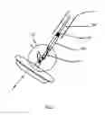 Fig. 07 - Occlusion device and surgical instrument and method for its implantation/explantation