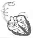 Fig. 01 - Method and system for detecting capture using a coronary vein electrode