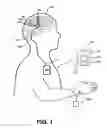 Fig. 02 - Systems and methods for enhancing or optimizing neural stimulation therapy for treating symptoms of parkinson's disease and/or other movement disorders